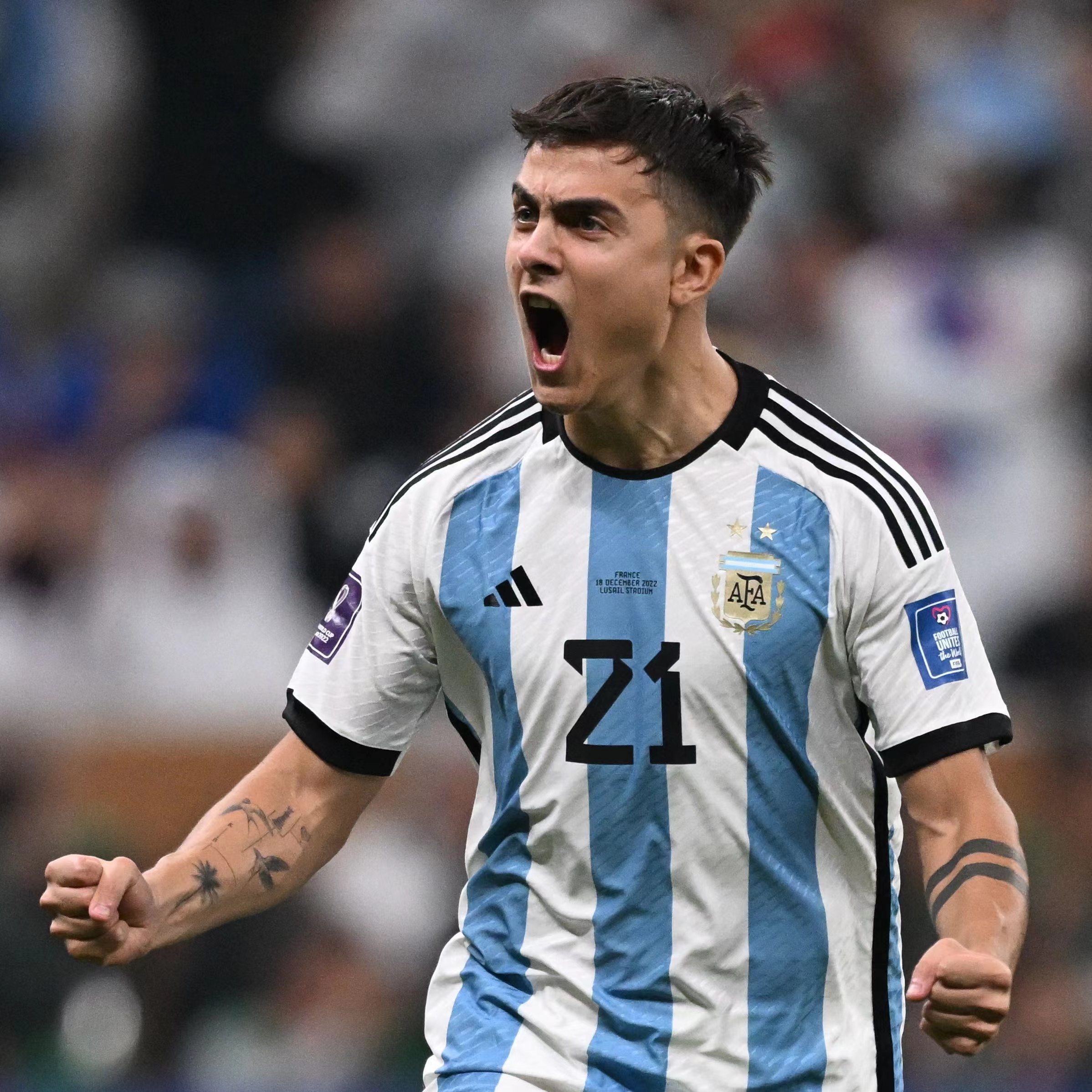 -包含阿根廷球星迪巴拉受伤，缺席下一场欧冠的词条